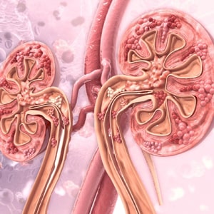 chronic-kidney-disease in Narasaraopet