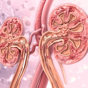 Chronic Kidney Disease Treatment